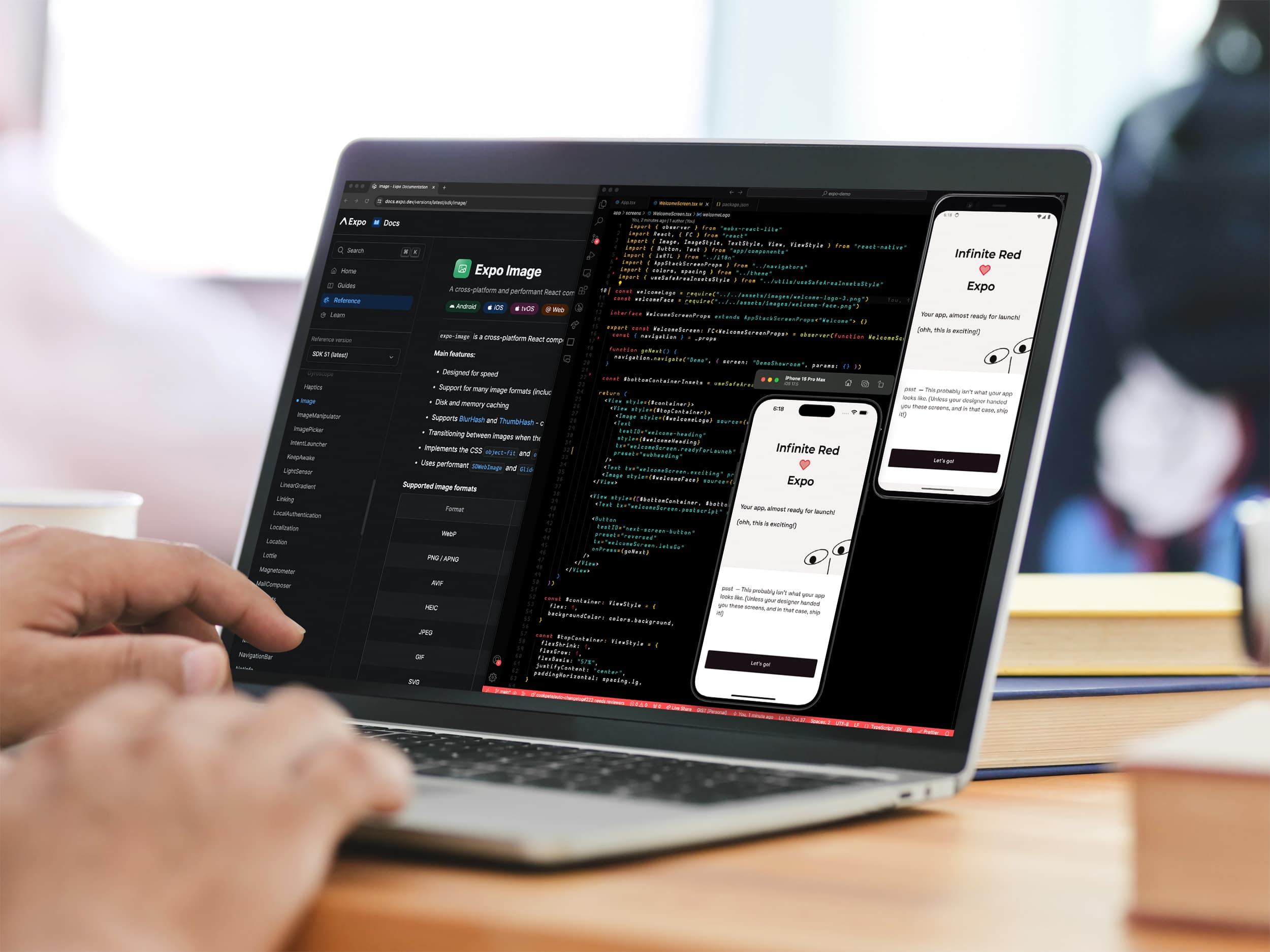 Expo development environment and mobile app previews on a laptop
